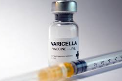 Chickenpox Vaccine FAQ Questions & Answers