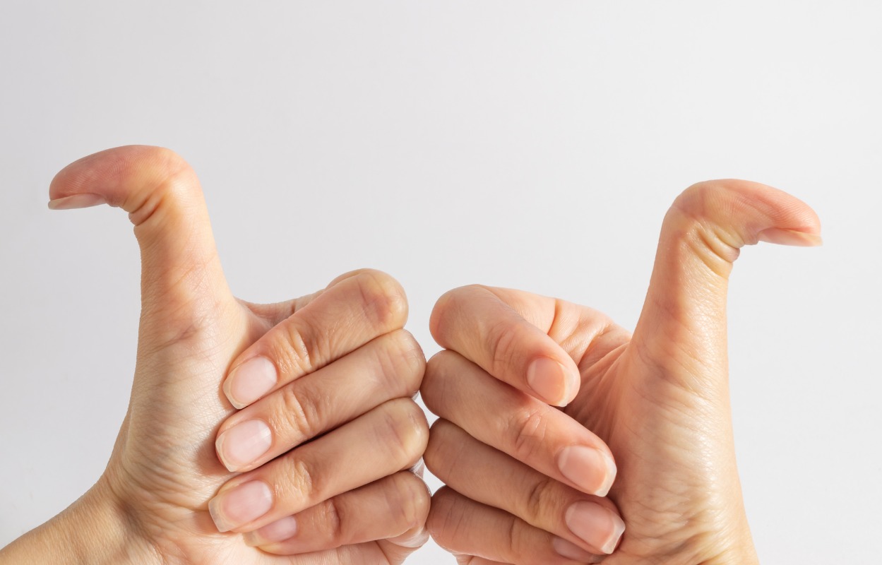 The Ehlers Danlos Syndrome Trivia Quiz